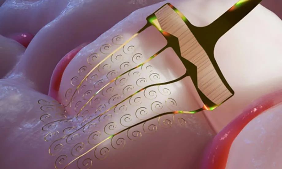 Chinese Scientists Develop Stretchable Brain Electrodes to Improve Thought-Controlled Devices